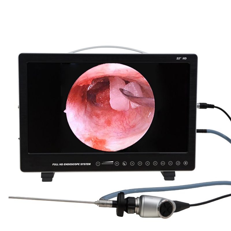 Sistema di telecamere per endo - Laptop Accessories All In One recensione e prezzo